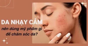Mỹ Phẩm Dành Cho Da Nhạy Cảm: "Cẩm Nang" Lựa Chọn An Toàn Và Hiệu Quả