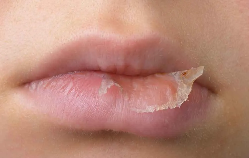 Những Thói Quen Cần Tránh Để Môi Không Bị Khô