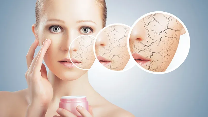 Top 7 Mỹ Phẩm Hỗ Trợ Trị Nám Hiệu Quả Được Nhiều Người Tin Dùng Hiện Nay